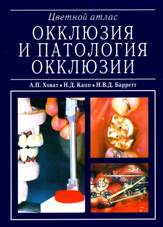 Окклюзия и патология окклюзии. Цветной атлас Окклюзия и патология окклюзии. Цветной атлас