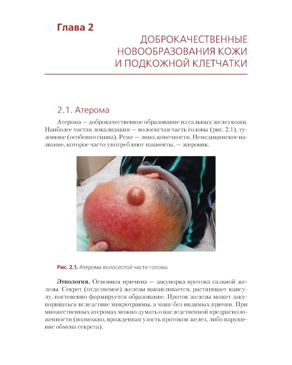 Амбулаторная хирургия, флебология, артрология для врачей и пациентов: Учебное пособие