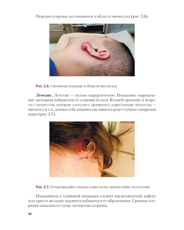 Амбулаторная хирургия, флебология, артрология для врачей и пациентов: Учебное пособие