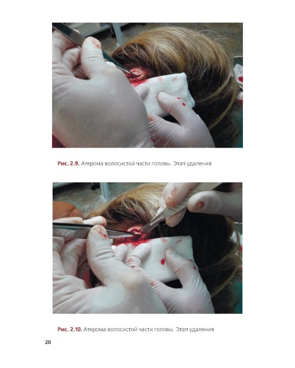 Амбулаторная хирургия, флебология, артрология для врачей и пациентов: Учебное пособие