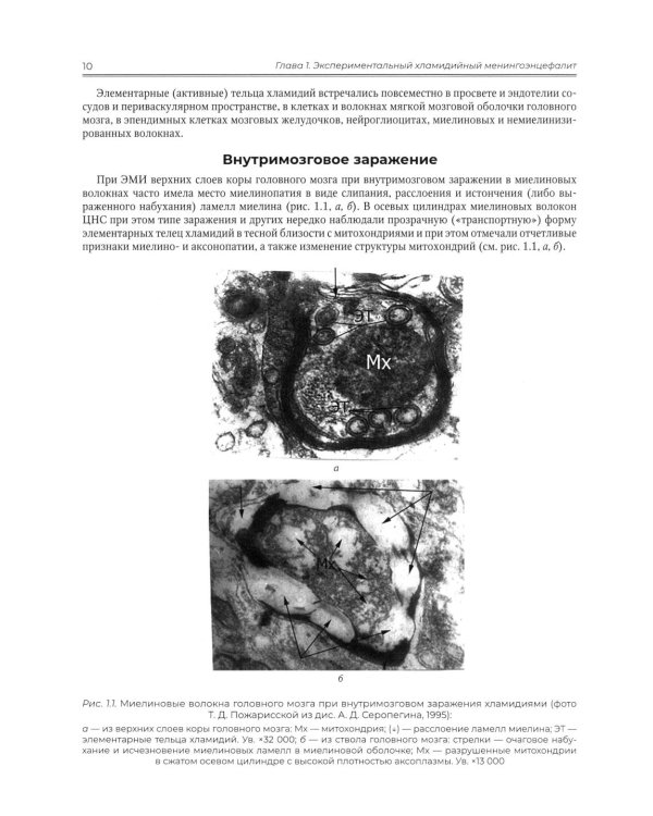 Ультраструктура нервной ткани при отдельных патологических состояниях нервной системы. Атлас  электронной микроскопии: Учебное пособие