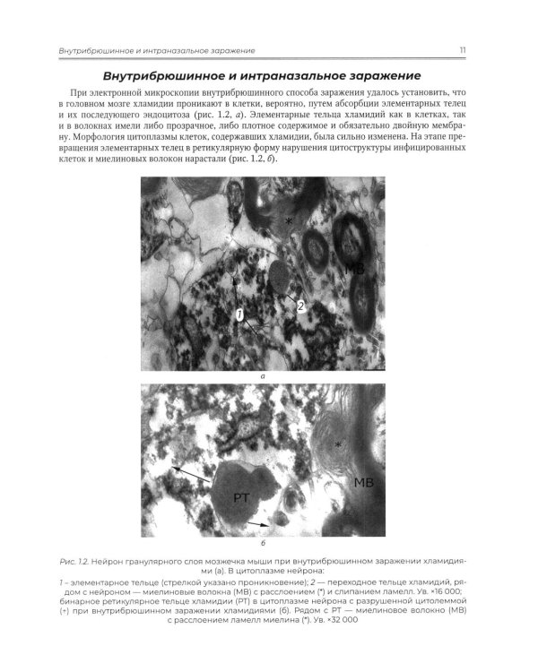 Ультраструктура нервной ткани при отдельных патологических состояниях нервной системы. Атлас  электронной микроскопии: Учебное пособие