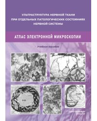 Ультраструктура нервной ткани при отдельных патологических состояниях нервной системы. Атлас  электронной микроскопии: Учебное пособие