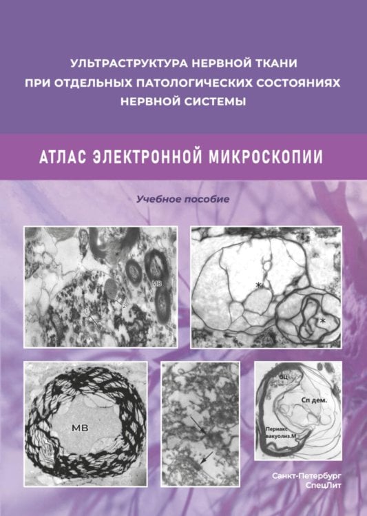 Ультраструктура нервной ткани при отдельных патологических состояниях нервной системы. Атлас  электронной микроскопии: Учебное пособие