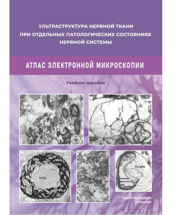 Ультраструктура нервной ткани при отдельных патологических состояниях нервной системы. Атлас  электронной микроскопии: Учебное пособие
