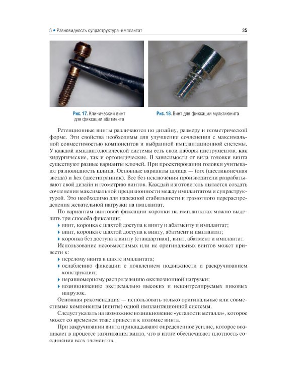 Имплантология: ключевые моменты: Учебное пособие