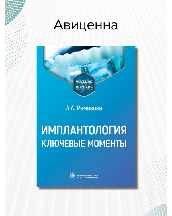 Имплантология. Ключевые моменты. Учебное пособие