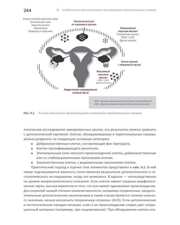 Международная классификация цитопатологии выпотных жидкостей