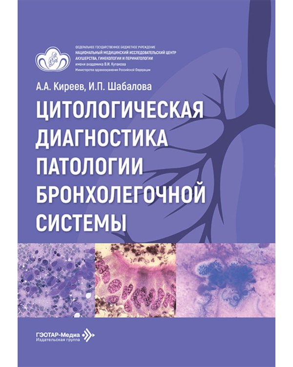Дополнительное изображение книги «Цитологическая диагностика патологии бронхолегочной системы»