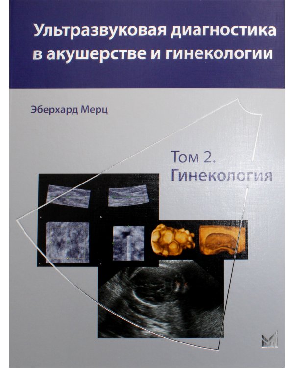 Ультразвуковая диагностика в акушерстве и гинекологии: В 2 т. Т. 2: Гинекология. 2-е изд