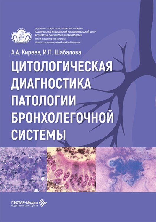Обложка книги «Цитологическая диагностика патологии бронхолегочной системы» — Шабалова Ирина Петровна;Киреев Андрей Андреевич, ISBN 9785002821082