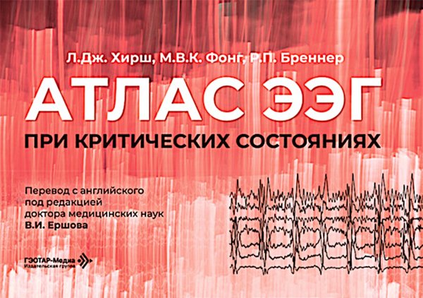 Атлас ЭЭГ при критических состояниях