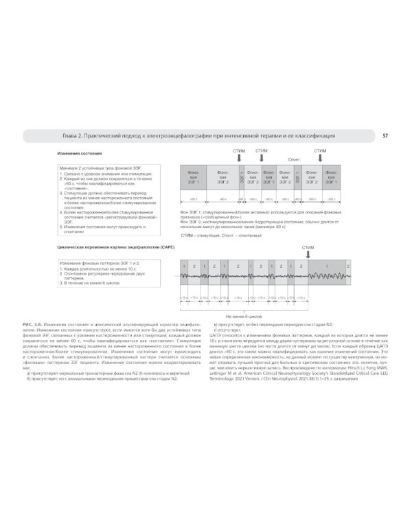 Атлас ЭЭГ при критических состояниях