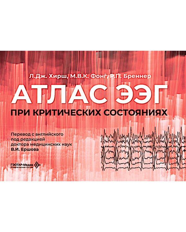 Атлас ЭЭГ при критических состояниях
