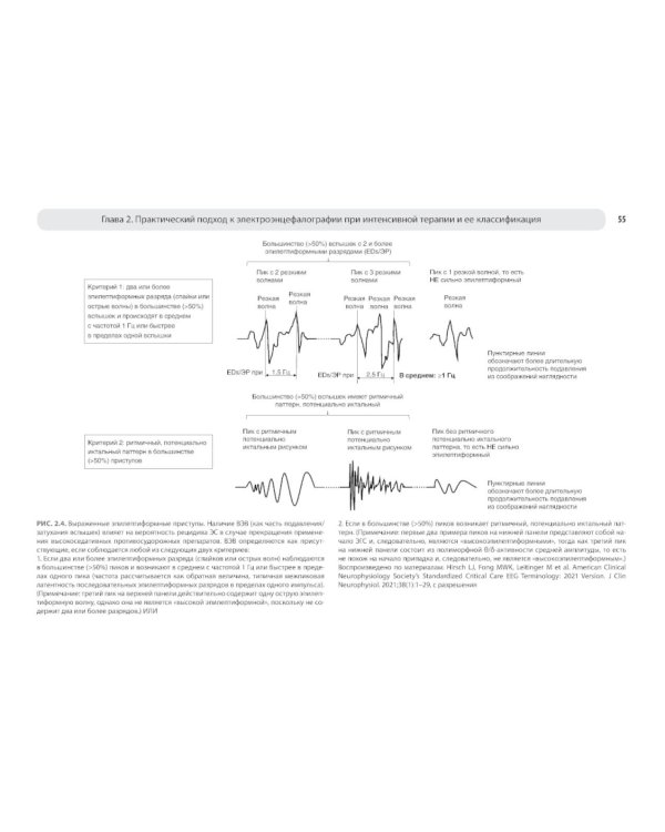 Атлас ЭЭГ при критических состояниях