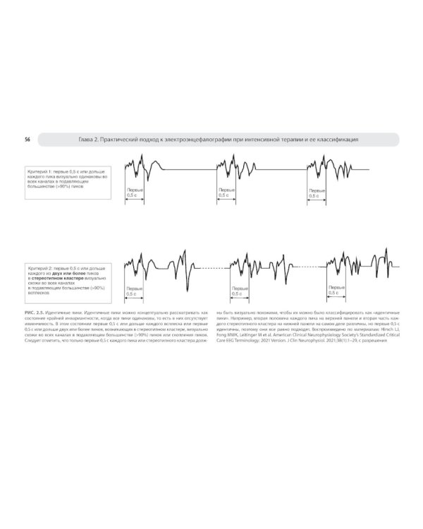 Атлас ЭЭГ при критических состояниях