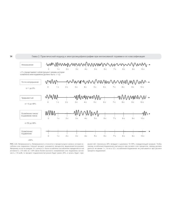 Атлас ЭЭГ при критических состояниях