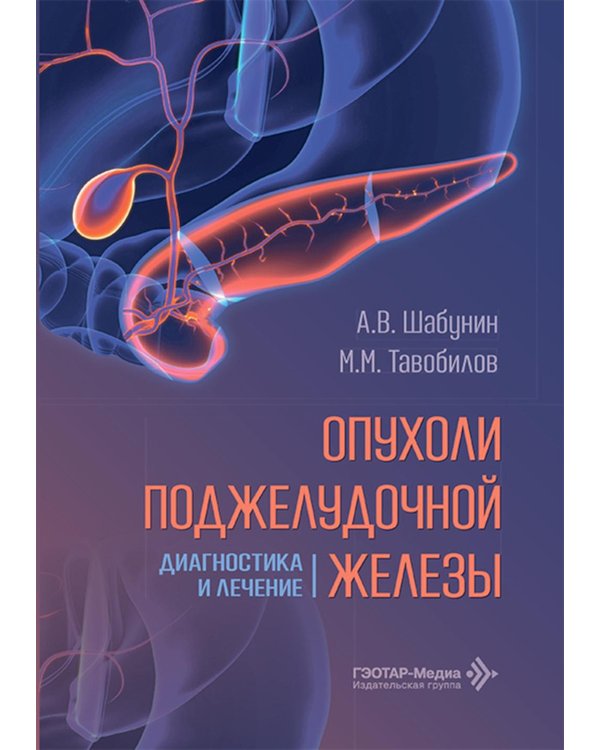 Дополнительное изображение книги «Опухоли поджелудочной железы: диагностика и лечение»
