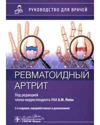 Ревматоидный артрит: руководство для врачей. 2-е изд., перераб. и доп
