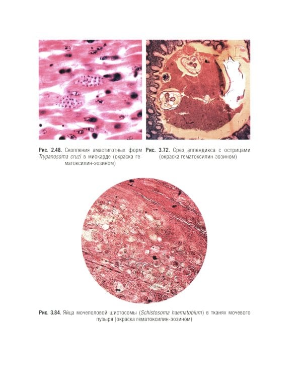 Медицинская паразитология и паразитарные болезни: Учебное пособие. 3-е изд., перераб. и доп