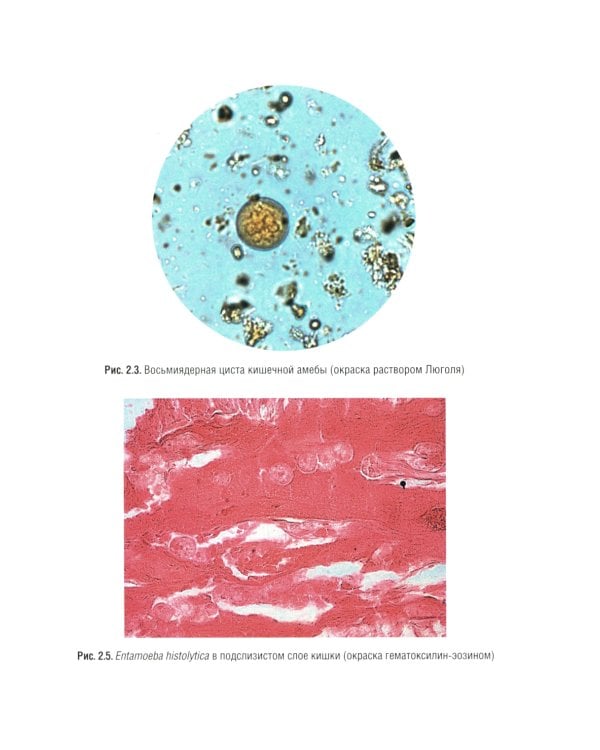 Медицинская паразитология и паразитарные болезни: Учебное пособие. 3-е изд., перераб. и доп