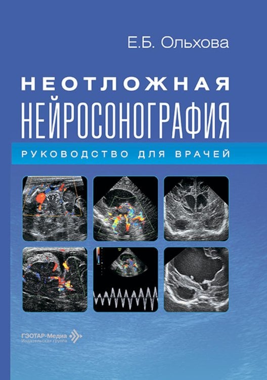 Обложка книги «Неотложная нейросонография: руководство для врачей» — Ольхова Елена Борисовна, ISBN 9785970497524