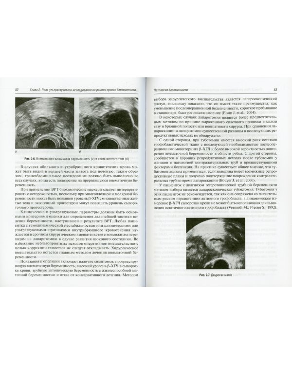 Ведение беременности ранних сроков, наступившей в результате протоколов ВРТ: руководство для врачей