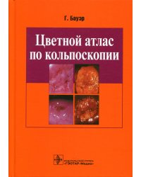 Цветной атлас по кольпоскопии