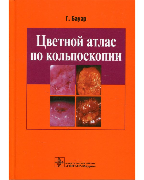Цветной атлас по кольпоскопии
