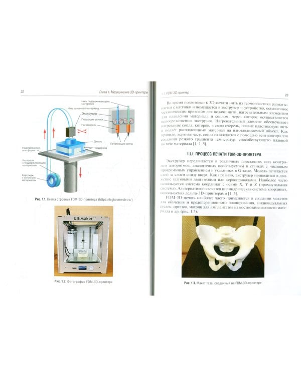 3D-печать в медицине