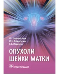 Опухоли шейки матки