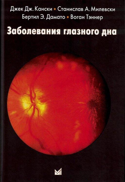 Заболевания глазного дна. 4-е изд Заболевания глазного дна. 4-е изд