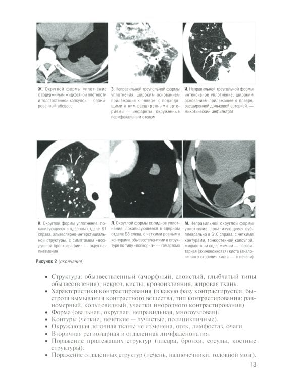 Заключение в торакальной компьютерной томографии. Симптом, синдром, диагноз. 2-е изд