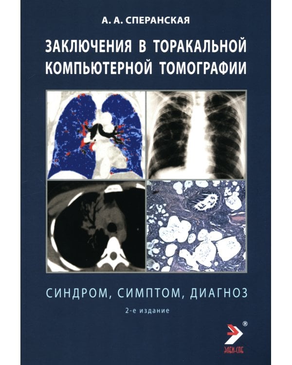 Заключение в торакальной компьютерной томографии. Симптом, синдром, диагноз. 2-е изд