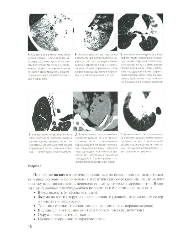 Заключение в торакальной компьютерной томографии. Симптом, синдром, диагноз. 2-е изд