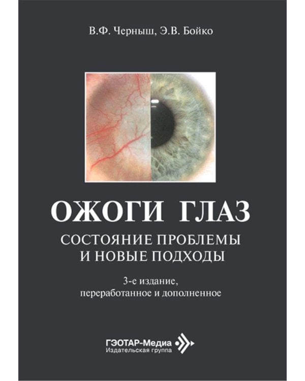 Ожоги глаз. Состояние проблемы и новые подходы. 3-е изд., перераб. и доп