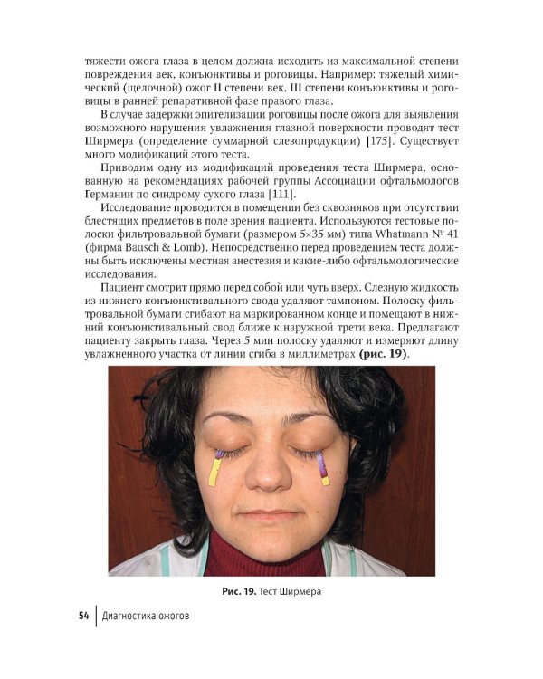 Ожоги глаз. Состояние проблемы и новые подходы. 3-е изд., перераб. и доп