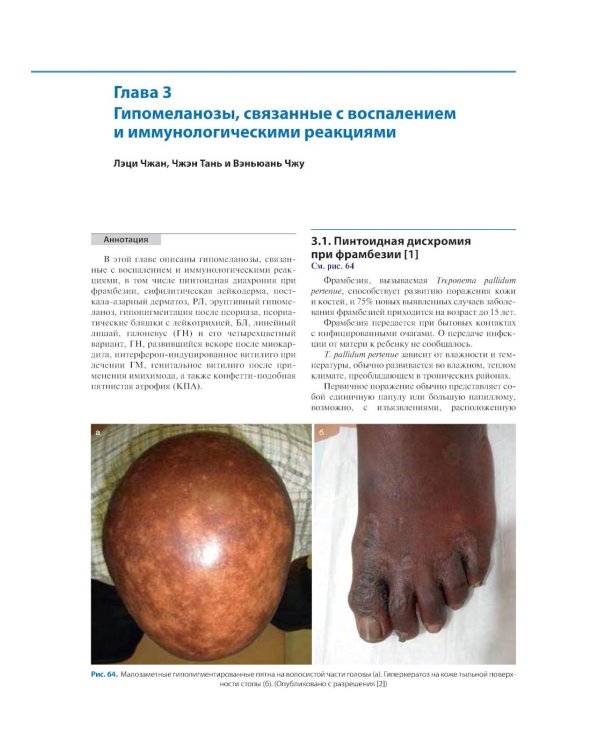 Атлас пигментных заболеваний кожи