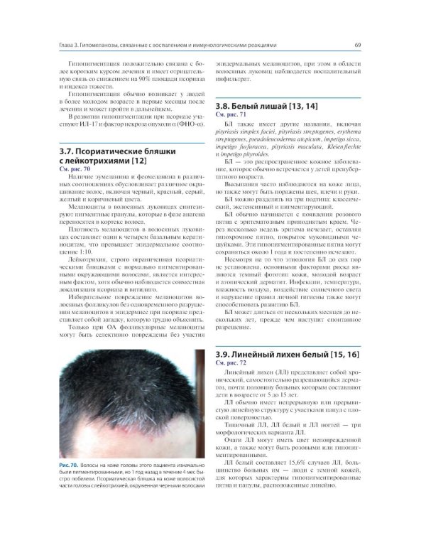 Атлас пигментных заболеваний кожи