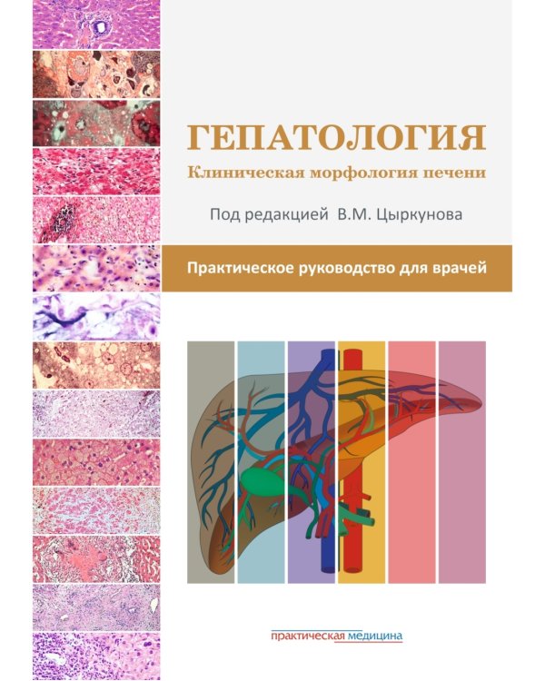 Гепатология. Клиническая морфология печени. Практическое руководство для врачей