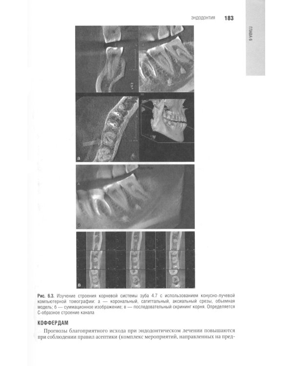 Терапевтическая стоматология: национальное руководство. 3-е изд., перераб. и доп