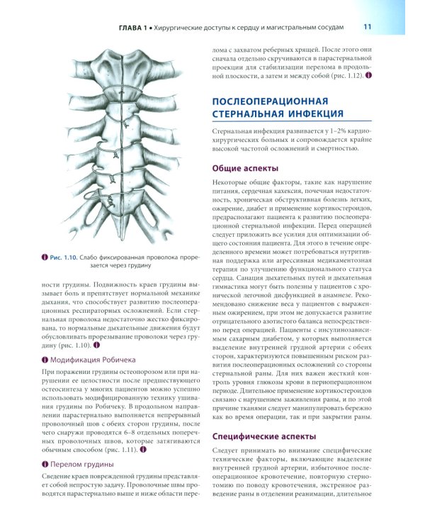 Кардиохирургия по Хонсари. Оперативная техника: предотвращение ошибок и принципы безопасности. 5-е изд