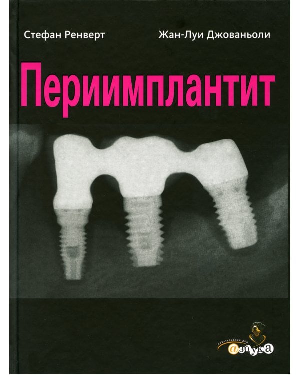 Периимплантит