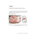 Руководство для врачей Судебная невропатология. Черепно-мозговая и спинальная травмы: руководство для врачей