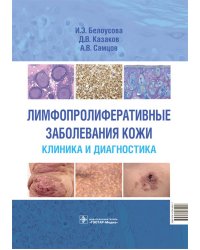 Лимфопролиферативные заболевания кожи. Клиника и диагностика