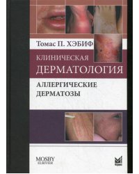 Клиническая дерматология. Аллергические дерматозы