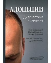 Алопеции. Диагностика и лечение