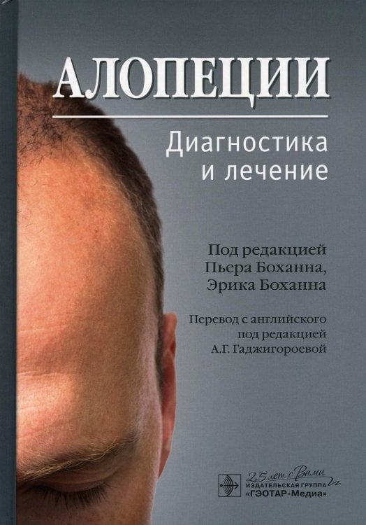 Алопеции. Диагностика и лечение Алопеции. Диагностика и лечение