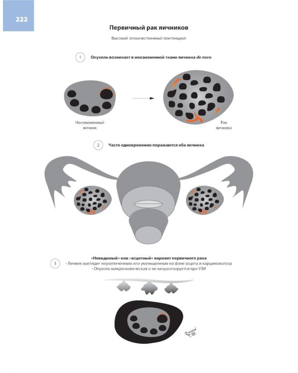 Атлас по ультразвуковой диагностике в гинекологии. 4-е изд