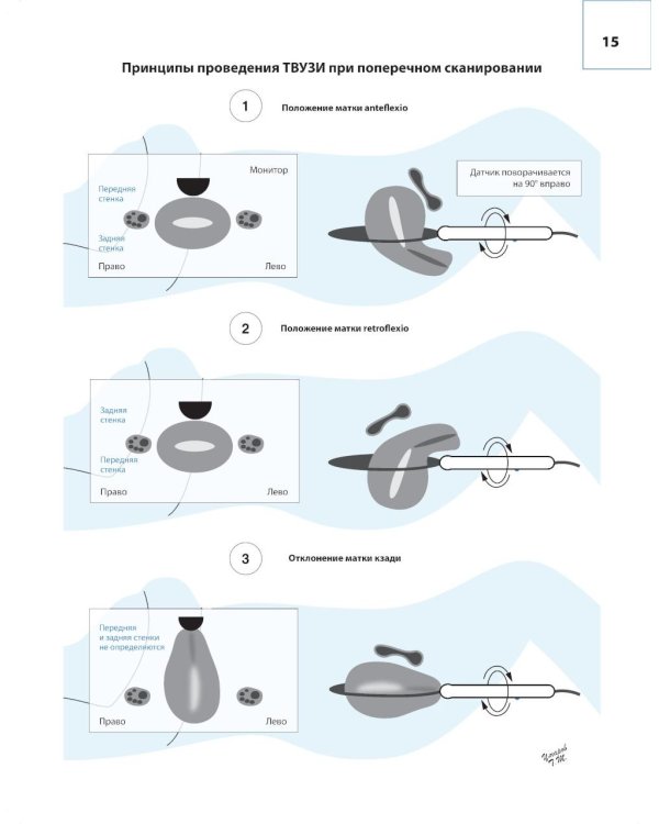 Атлас по ультразвуковой диагностике в гинекологии. 4-е изд